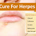 Cure for Herpes with Different Home Remedies