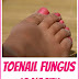 Discover the Best Essential Oils for Toenail Fungus!