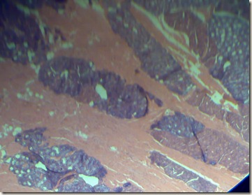Mucous(purple)serous(pink) high magnified view