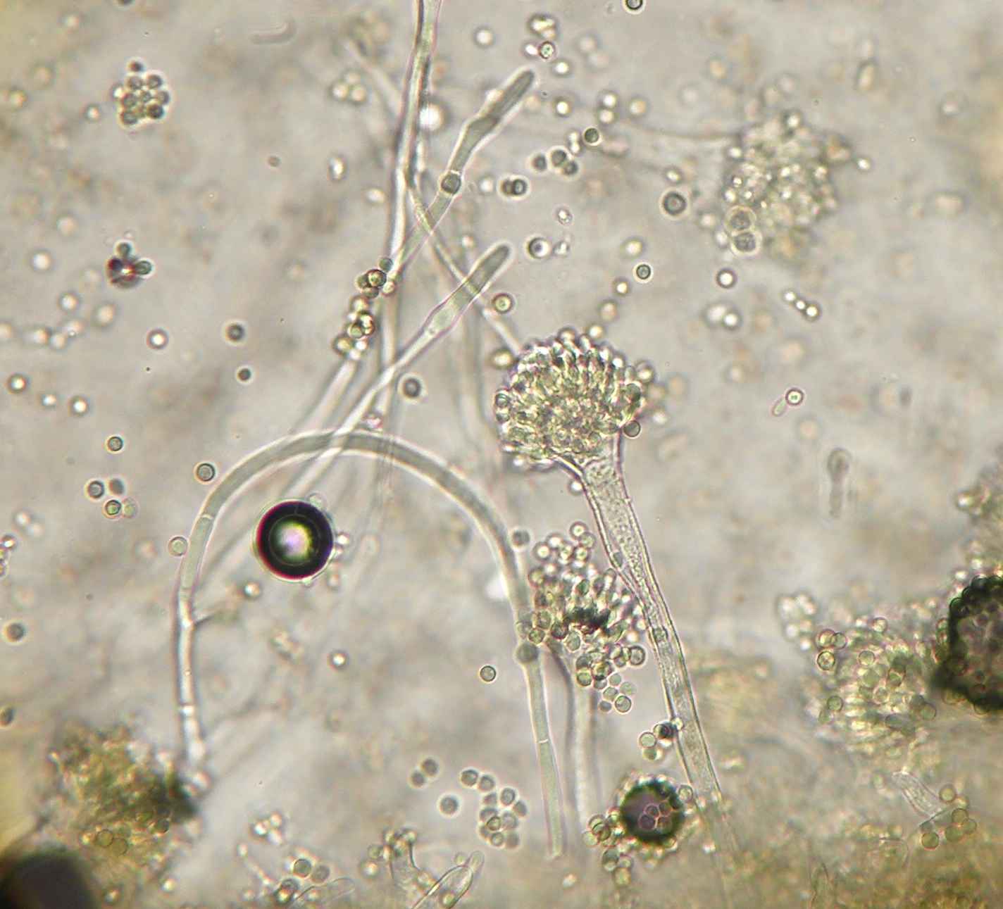 ATLAS MICOLOGIA: ABCESSO DA CORNEA - ASPERGILLUS FLAVUS