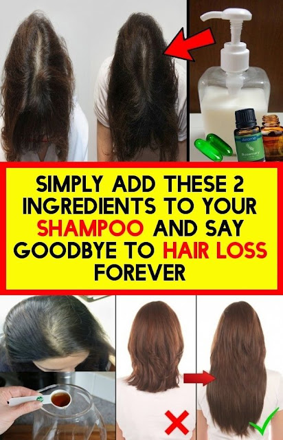 Simply Add These 2 Ingredients To Your Shampoo And Say Goodbye To Hair Loss Forever