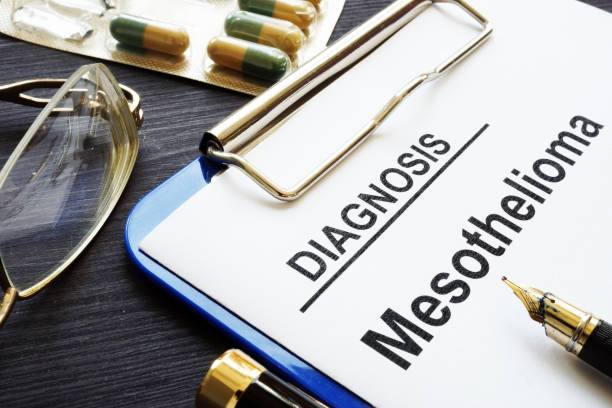 Best Mesothelioma Attorney Near Me: Seeking Legal Assistance for Mesothelioma Cases