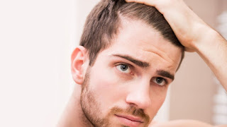 Healthy Hair Loss Treatment