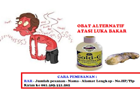 obat tradisional mengobati luka bakar dengan Herbal