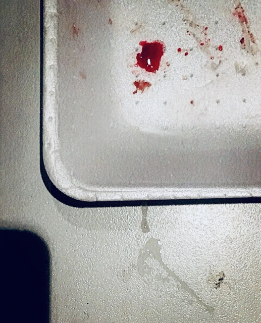 Blood on white packaging
