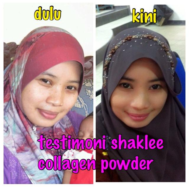 Hilang kedutan di wajah denga Collagen Powder Shaklee