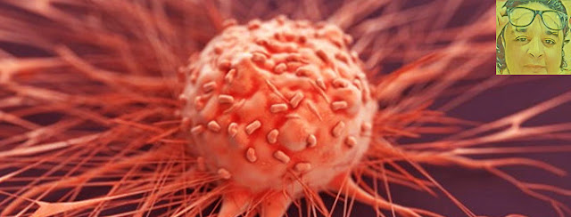 لماذا يصاب الجسم بالسرطان: رحلة في عالم الخلايا المتمردة