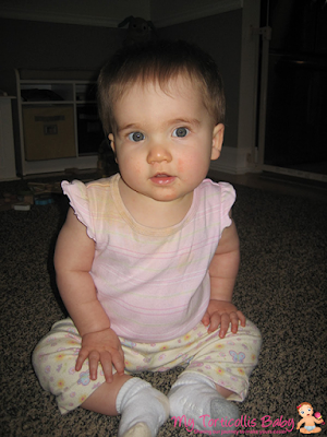 Baby with her head tilted slightly to her right due to torticollis.