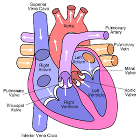 What is Heart Attack? heart attack diagram. What is Heart Attack?
