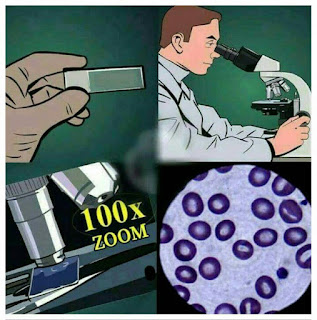 100X ZOOM BLOOD SAMPLE