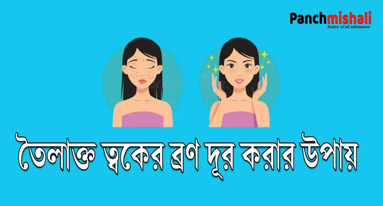 তৈলাক্ত ত্বকের ব্রণ দূর করার উপায়