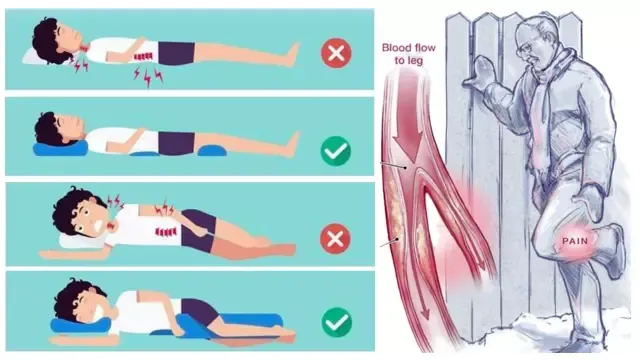 Best Sleeping Position For Peripheral Artery Disease