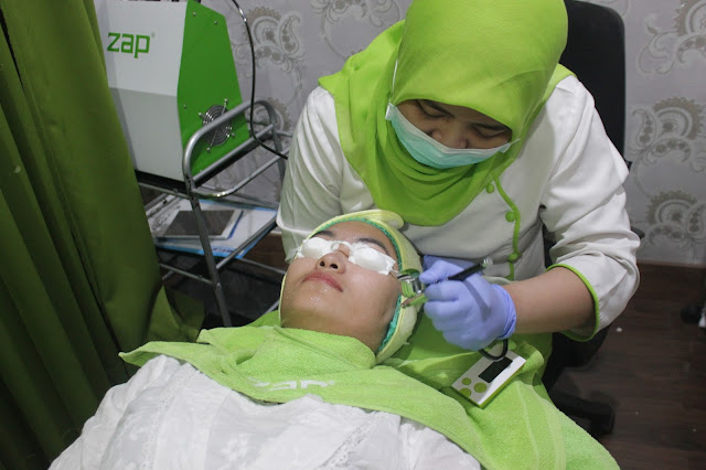 review zap photo facial