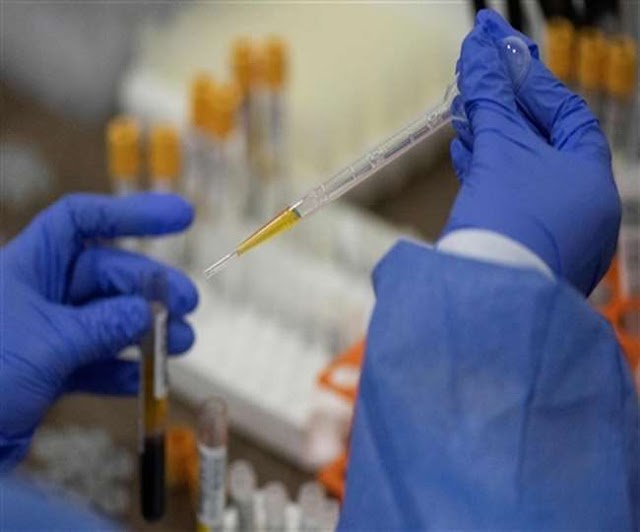 @News circuit ⭕ special/Australia: HIV antibodies found in COVID-19 vaccine test, trials halted,ऑस्ट्रेलिया: COVID-19 वैक्सीन के टेस्ट में मिली HIV ऐंटीबॉडी, रोक दिए गए ट्रायल..