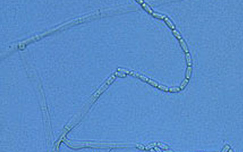 Bretziella fagacearum oak wilt disease fungus