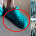 Caution - You Have Another Reason For Not Using Crocs More - Share It So That It Does Not Repeat