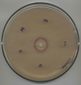Test de potentiel antibiotique réalisé sur gélose avec disques