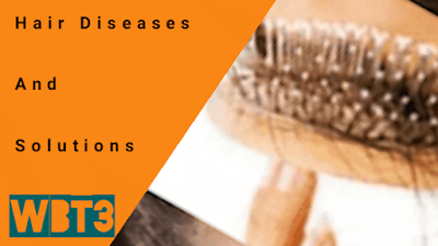 <img src="Hair Diseases.jpg" alt="Hair Diseases and Solutions/>