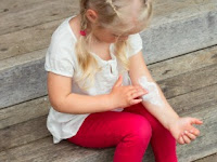 Eczema: How to Help Your Child Avoid the Itch