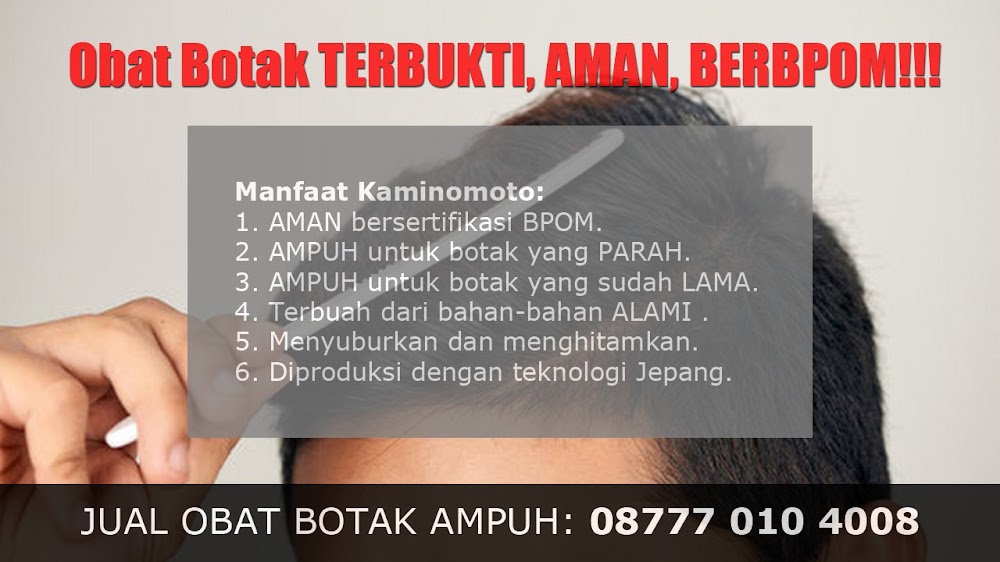 CARA MENUMBUHKAN RAMBUT HALUS DI KEPALA<br/>Belopa<br/>