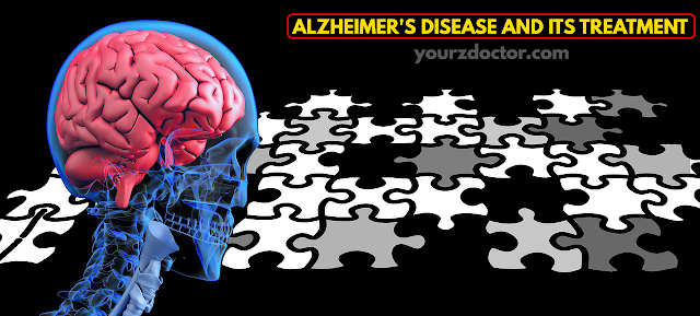 Alzheimer's disease and its treatment