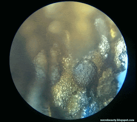  Wheat Bread. Magnification 100 times. 