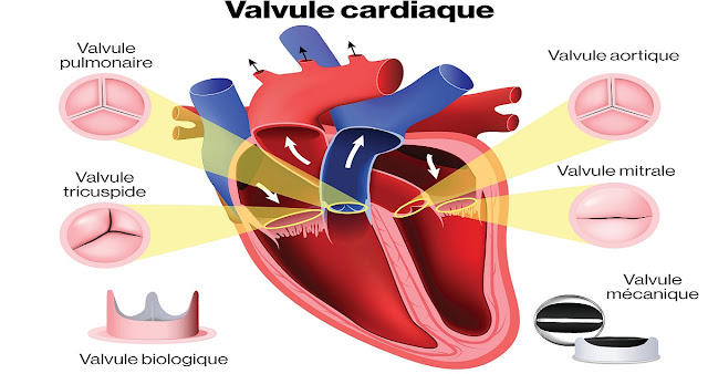 valve-cardiaque -congénitale