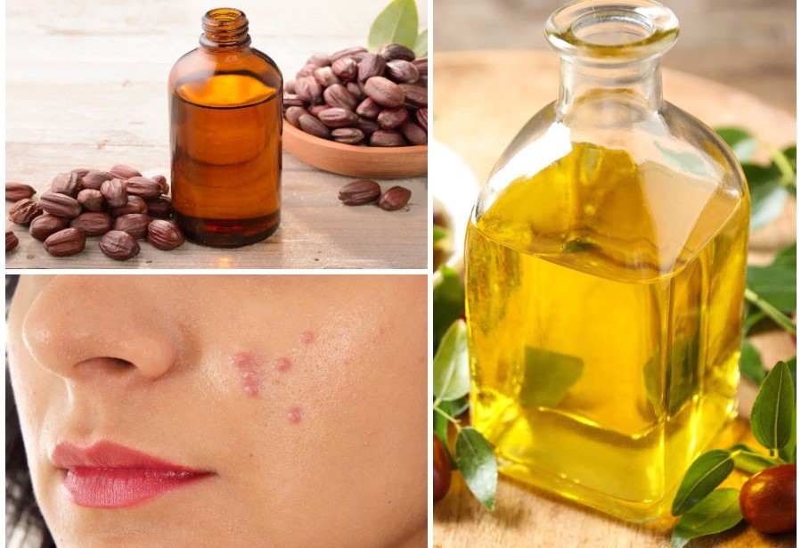 Does Jojoba Oil Clog Pores: Jojoba Oil Benefits for Face, Hair & Body