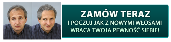 wypadanie włosów tabletki