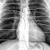 Chest radiograph