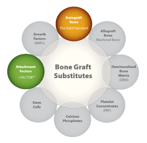 bone graft substitues dnb ms ortho