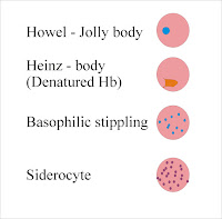 Howell jolly bodies vs Heinz body