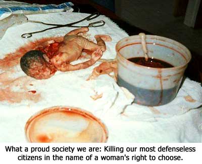 ( ABOVE : A MURDERED black baby via 