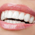 Niềng răng bí mật có nghĩa là gì?