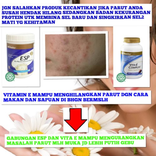 Ubat Parut di Muka dan Badan  PAKAR CANTIK