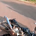 HOMEM COM O PERNA SEMI-DECEPADA APÓS  GRAVE ACIDENTE DE MOTO 