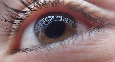 ग्लूकोमा क्या है  glaucoma kya hai