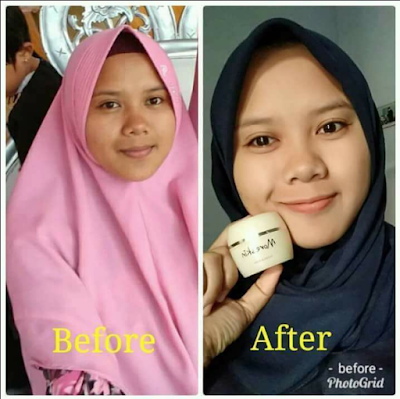 Testimoni MORESKIN CLEAN & GLOW