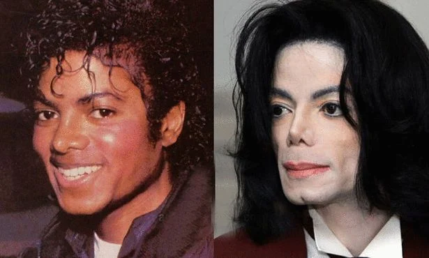 From lost childhood to extreme surgery: Michael Jackson's nose tells of his entire life
