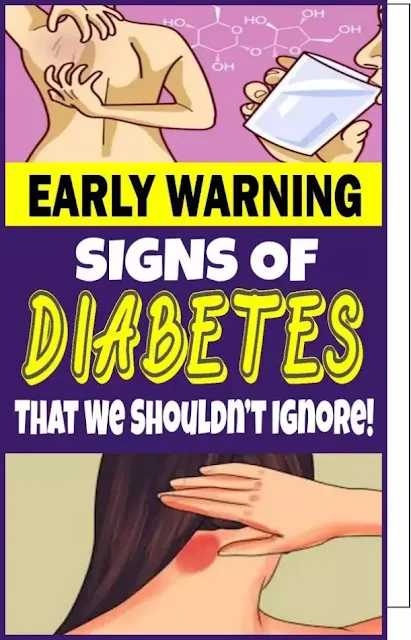 Don`t Ignore These Early Signs Of Diabetes 