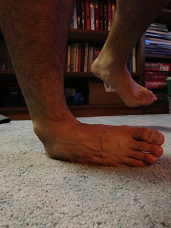 Saiba mais sobre as entorses de tornozelo | Fisioterapia
