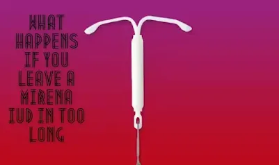 What Happens If You Leave A Mirena IUD In Too Long