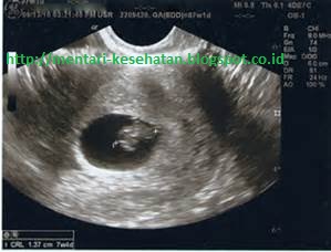 Permainan Apa Saja Yang Cocok Untuk Si Superbaby Yang Tepat Dengan Usianya