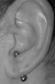 tragus piercing