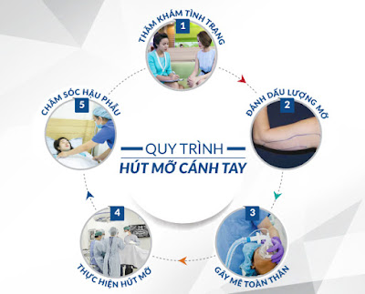 Hút mỡ bằng công nghệ nội soi laser lipo với quy trình đạt chuẩn nghiêm ngặt tại BV KIM luôn khiến khách hàng yên tâm về độ an toàn và hiệu quả cao