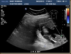 BABY ROBBINS20120922175631944