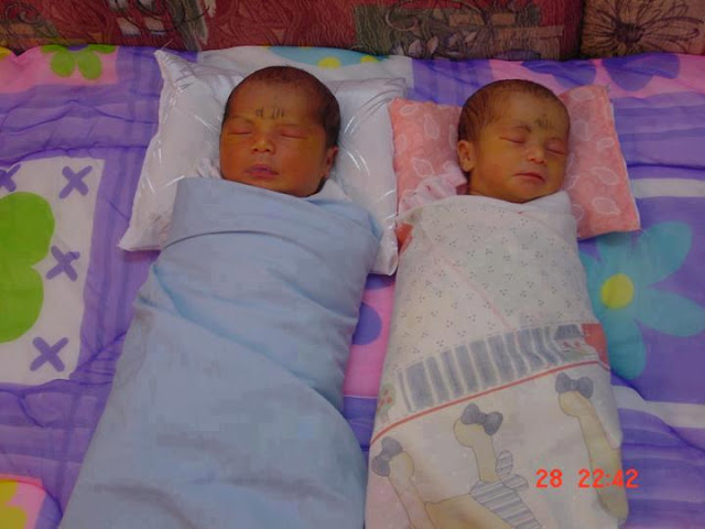 These two children were born with the name Allah written on his forehead ..