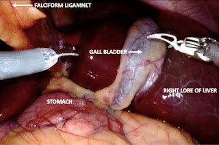 Robotic gall bladder salary in AIIMS Rishikesh