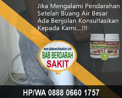 Obat Kampung Untuk Wasir