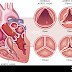 فهم مرض صمامات القلب: خطورته، أعراضه، وخيارات العلاج